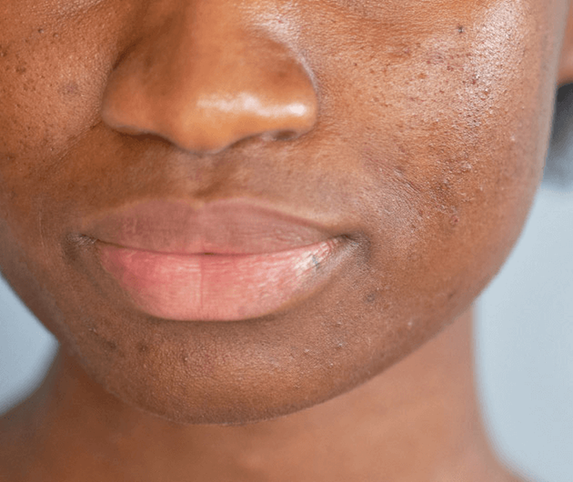 Our Formulation Superiority