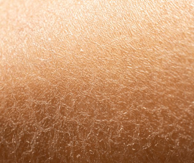 What is Dehydrated Skin?