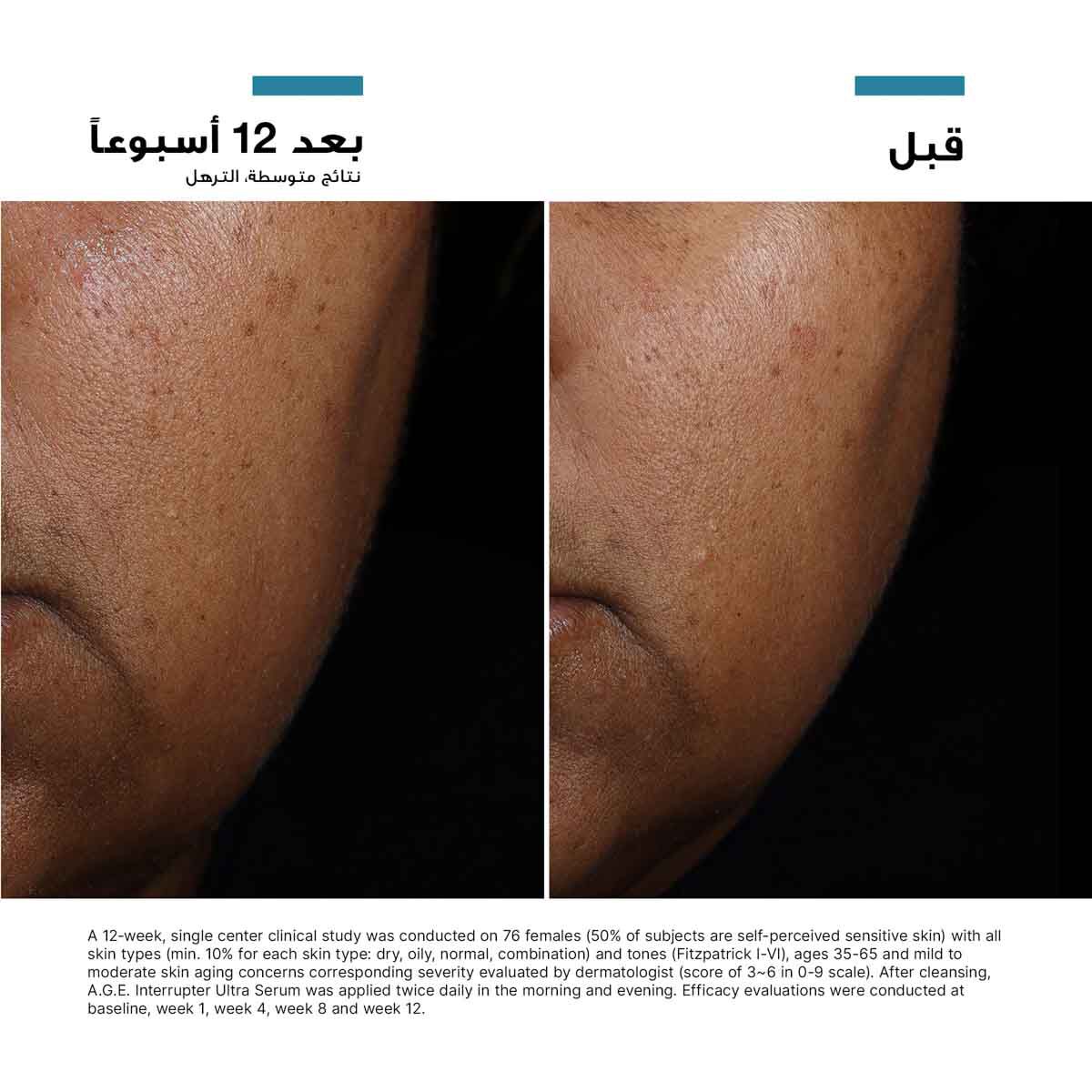 A.G.E. Interrupter Ultra Serum