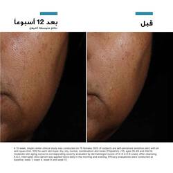 A.G.E. Interrupter Ultra Serum