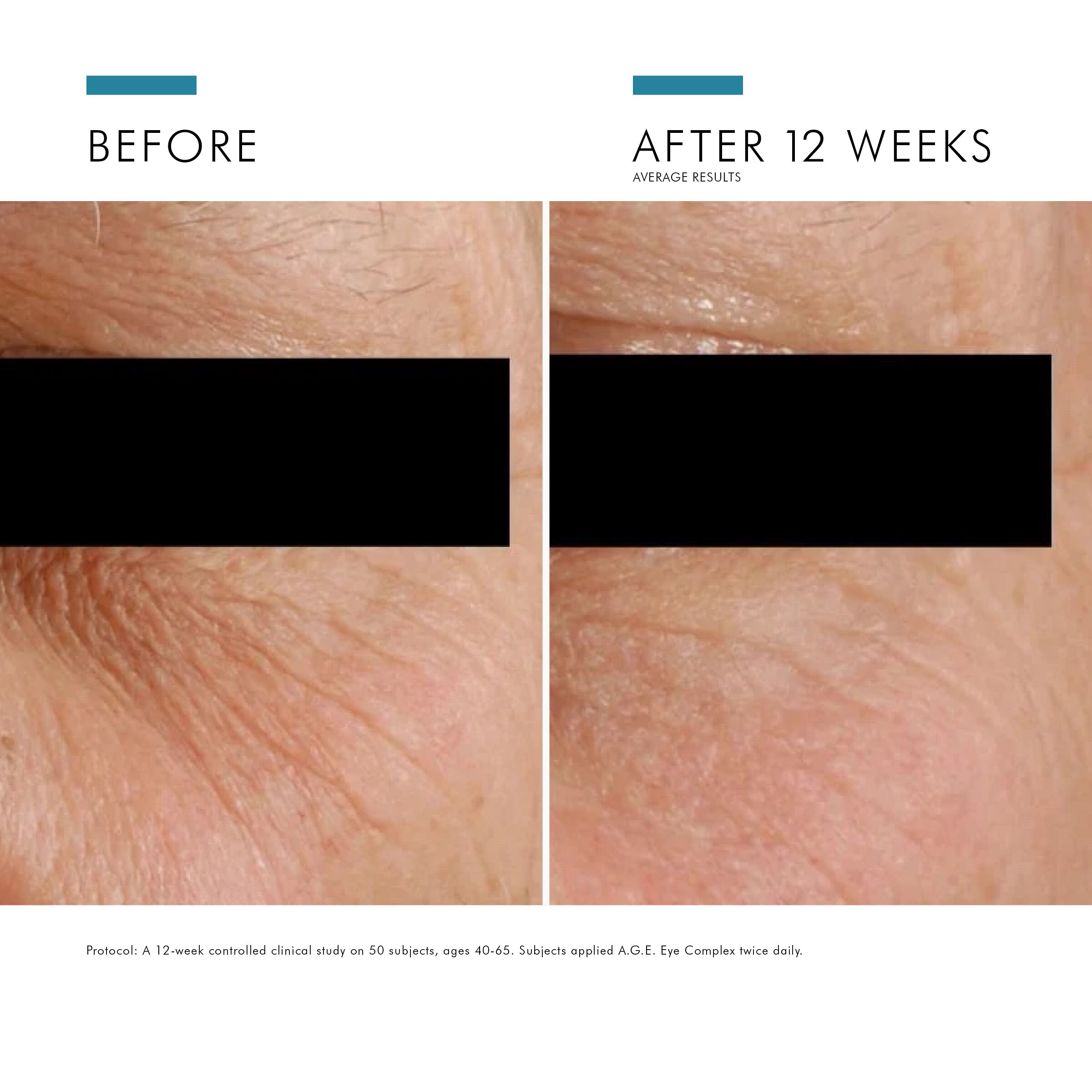 كريم العيون A.G.E. EYE COMPLEX لتخفيف الهالات السوداء