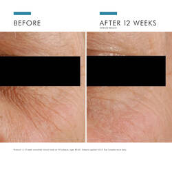 كريم العيون A.G.E. EYE COMPLEX لتخفيف الهالات السوداء