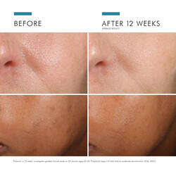 PHLORETIN CF® WITH FERULIC ACID