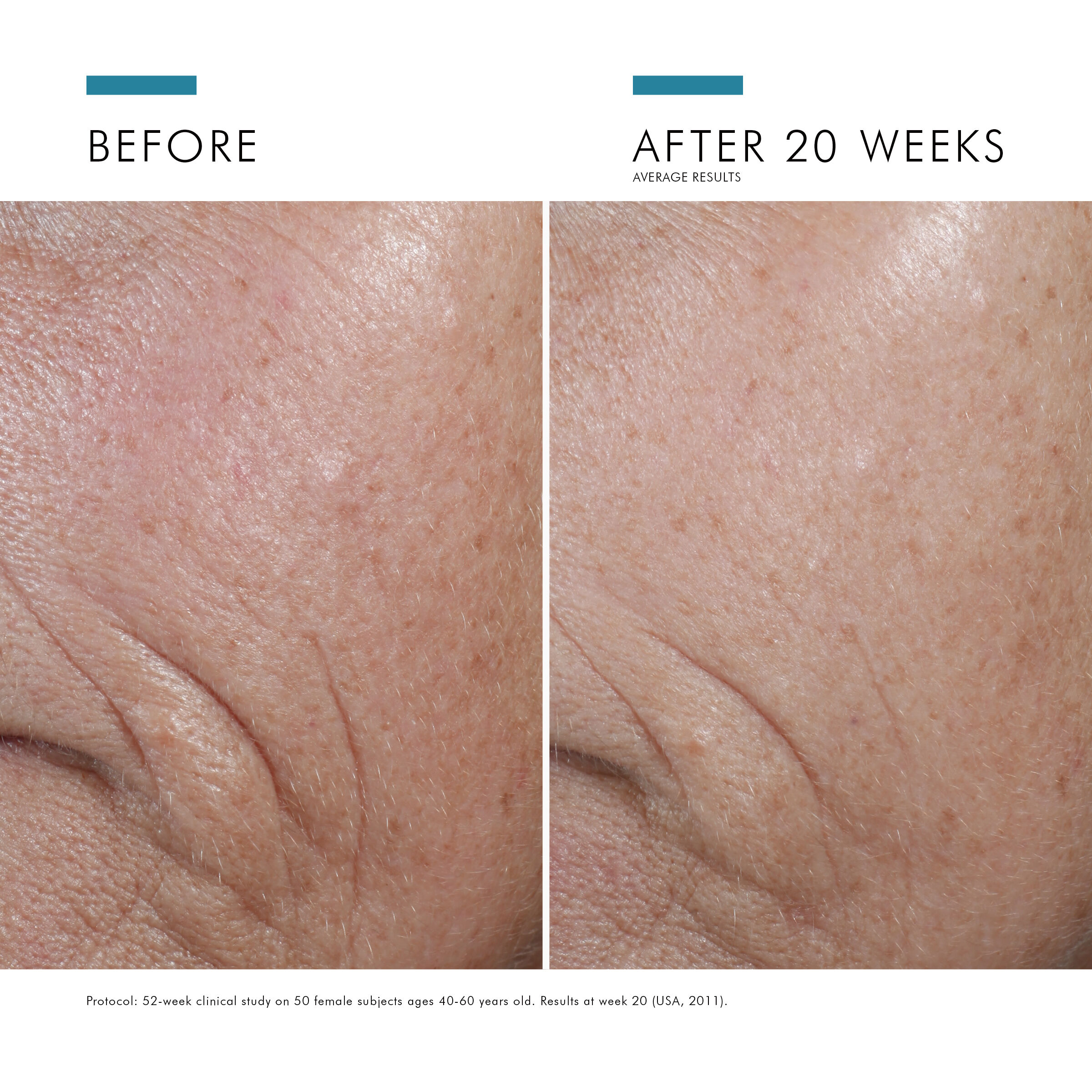 C E Ferulic® with 15% L-ascorbic acid