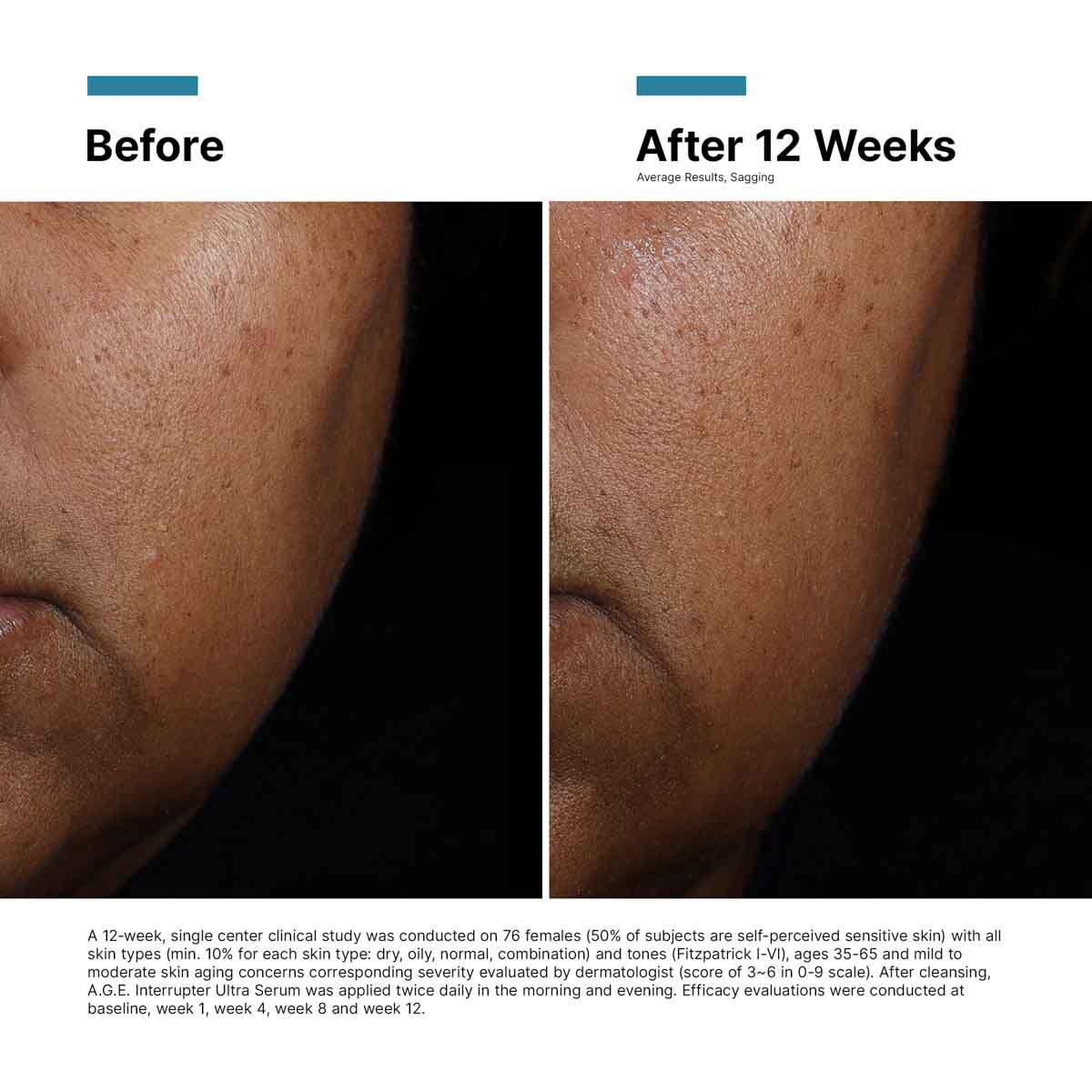 A.G.E. Interrupter Ultra Serum