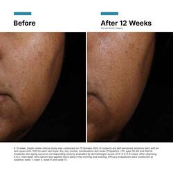 A.G.E. Interrupter Ultra Serum